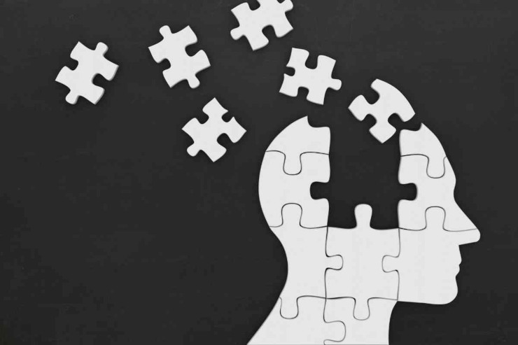 Cervello puzzle